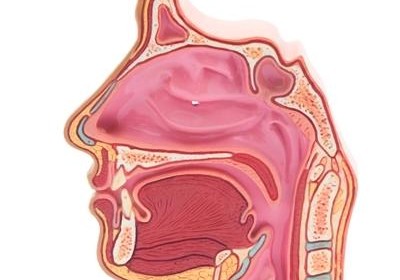 Cordectomie par voie endoscopique au laser