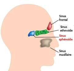 Sphénoïdotomie par voie endonasale