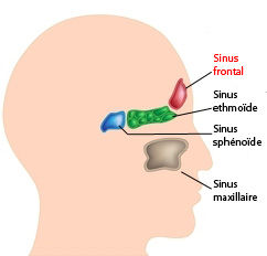 Exérèse d’une lésion bénigne du sinus frontal par voie orbitaire